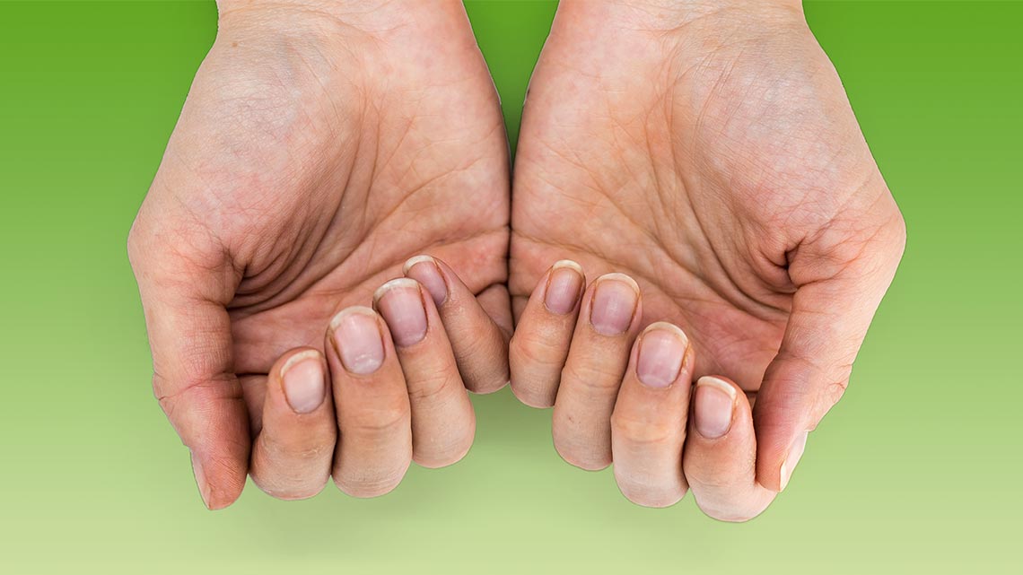 Come ridare vita alle unghie